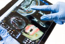 Bucura-te de viata cu implant dentar Fast and Fixed